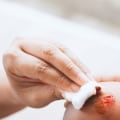 How to Tell If a Cut Is Infected or Healing Using Trusted Medical Guidance