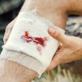How to Treat Wounds That Won’t Heal Safely and Effectively at Home or With Medical Care