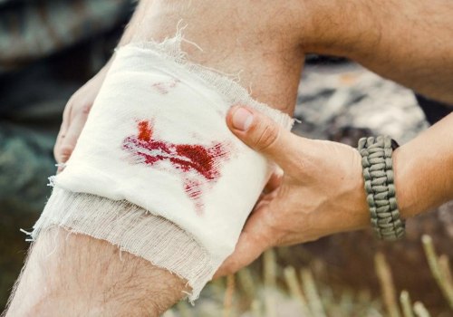 How to Treat Wounds That Won’t Heal Safely and Effectively at Home or With Medical Care